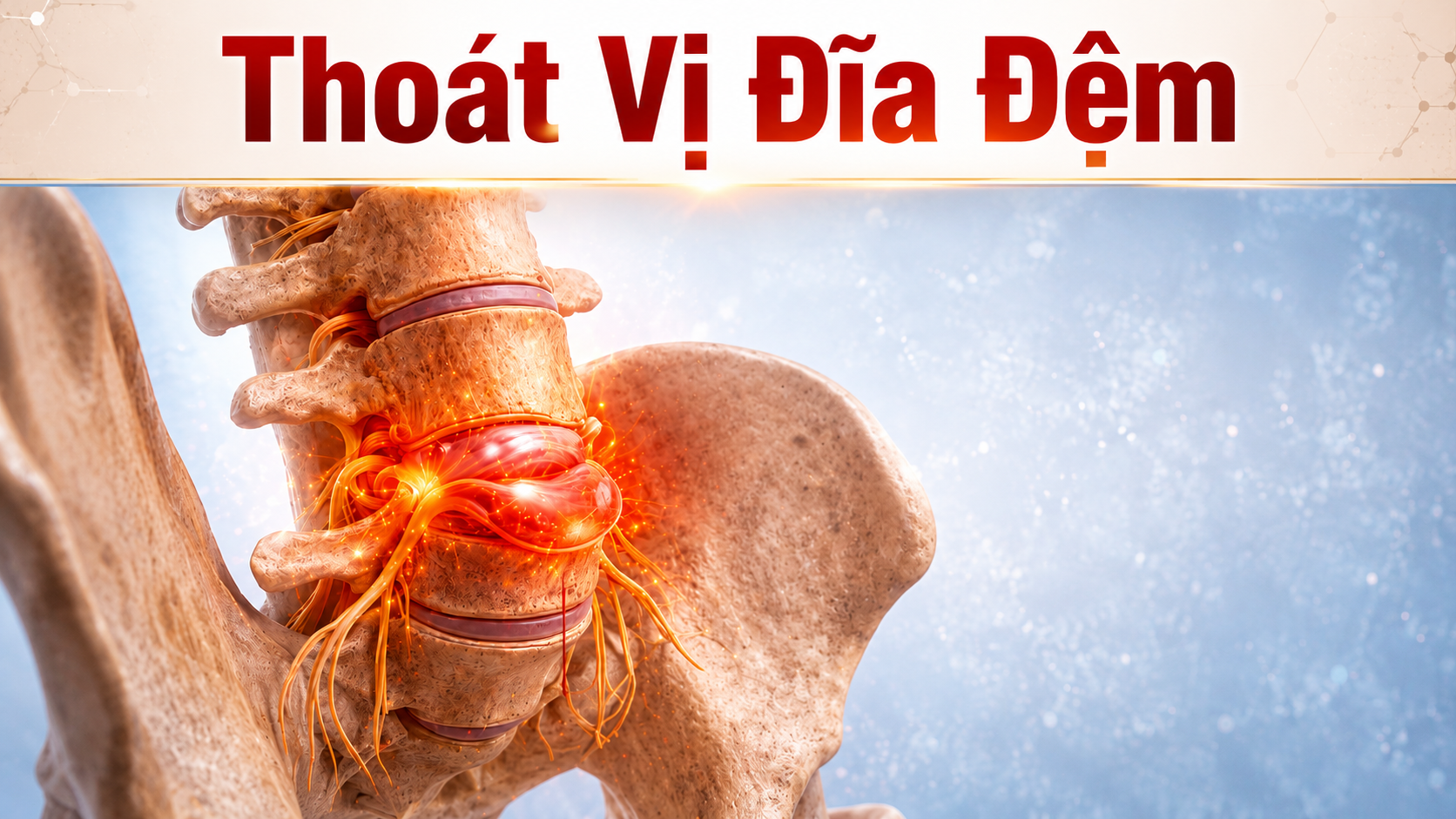 Thoát Vị Đĩa Đệm: Tập Đúng Từ Giai Đoạn Sớm Có Thể Cứu Cột Sống Của Bạn 6 Hình ảnh thoát vị đĩa đệm cột sống thắt lưng — tập đúng giai đoạn sớm phục hồi an toàn cùng Học viện Yoga T.Kim